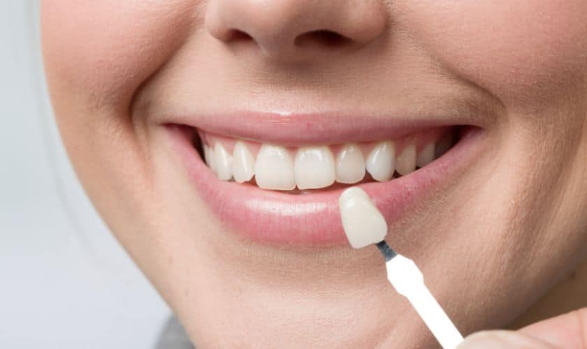 Transforming Your Smile: How to Choose the Right Dentist for Veneers Near Me